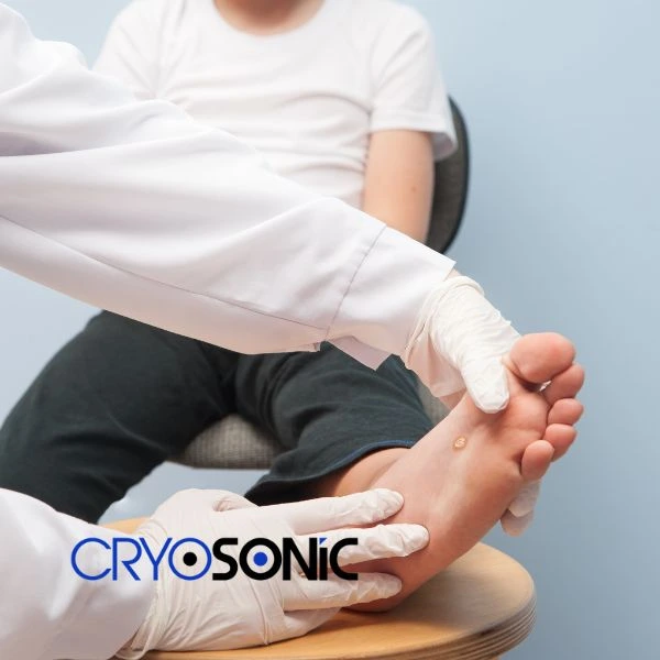 Are you looking for fast effective wart removal Contact us today Wootton-Bassett