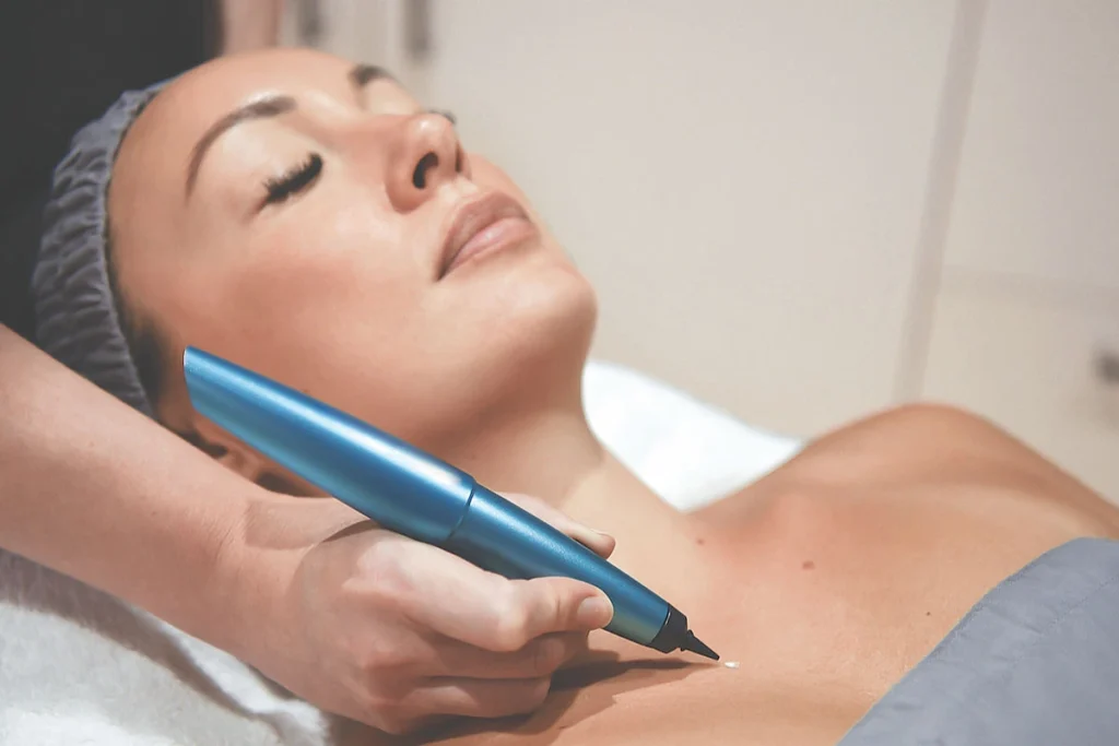 What is CryoPen Technology Wootton-Bassett? Wootton-Bassett