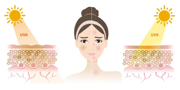 Understanding Sun Damage Wootton-Bassett : How Do UV Rays Cause Changes in the Skin? Wootton-Bassett